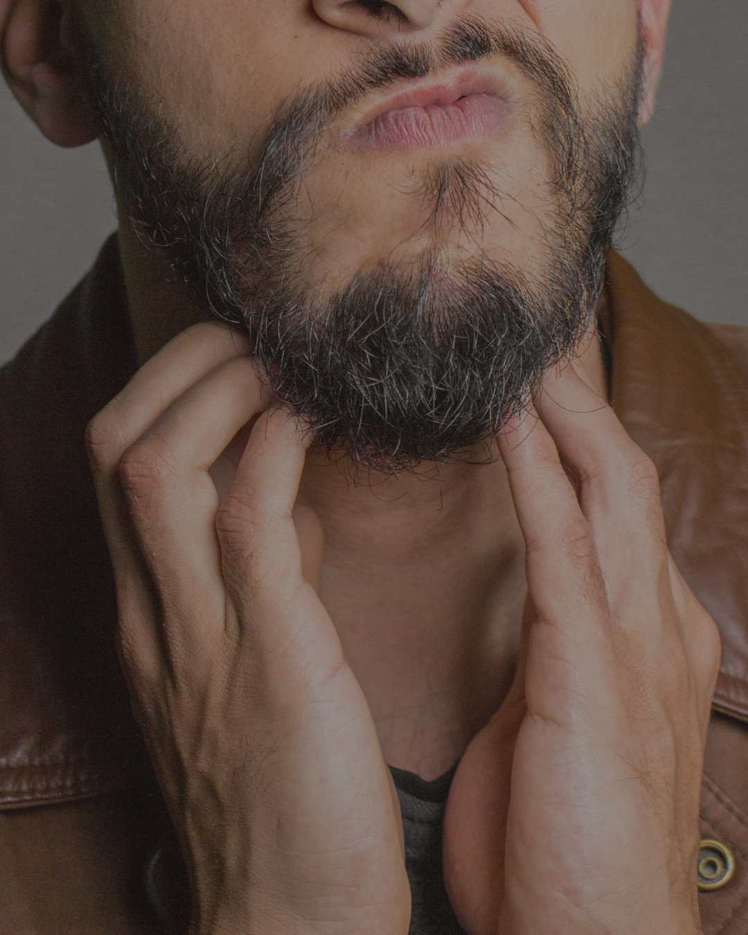 How to Get Rid of Beard Dandruff: The Complete Guide